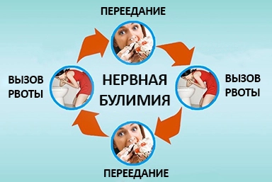 Лечение булимии в Петровской